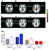 Effect of the FTO rs9939609 genotype on BOLD responses to food and non-food