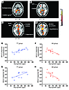 Modulatory effects of acyl-ghrelin on BOLD responses in the fasted state.