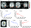 Modulatory effects of acyl-ghrelin on BOLD responses in the fed state.