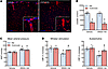 PVM depletion by CLOD restores neurovascular function in ANGII slow pressor