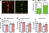 PVM At1r deletion counteracts the harmful cerebrovascular effects of ANGII