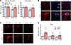 NOX2 in PVMs is required for the cerebrovascular effects of ANGII slow pres