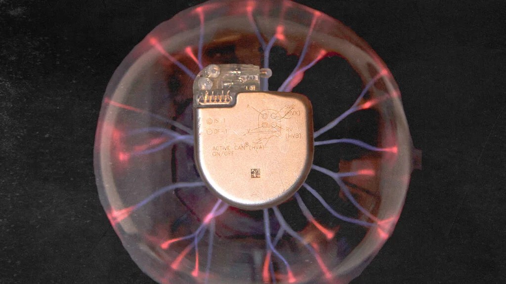 An implantable cardioverter defibrillator surrounded by waves of electricity.