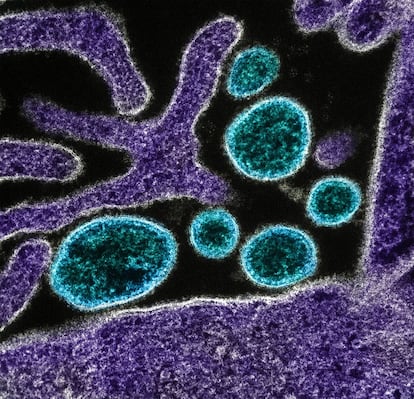 Partículas extracelulares del Virus Nipah cerca de la periferia de una célula infectada. La infección por el virus Nipah (VNi) es una zoonosis que emergió en 1998 en Malasia y ha provocado varios brotes en Asia. Aunque la cifra de infectados no sea muy alta, de pocas decenas de afectados por brote, la OMS estima que la tasa de letalidad varía entre el 40% y el 75% de los casos. El huésped natural del virus es el murciélago frutero de la familia 'Pteropodidae' y puede afectar a los cerdos y otros animales domésticos. Las manifestaciones clínicas van desde un proceso asintomático hasta un síndrome respiratorio agudo o una encefalitis mortal y no hay ninguna vacuna por ahora.