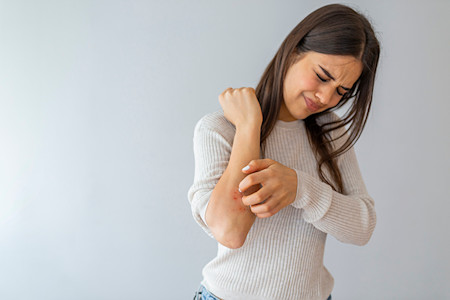 Photo depicting a person scratching a rash for AAD article: Rash 101 in adults: When to seek medical treatment