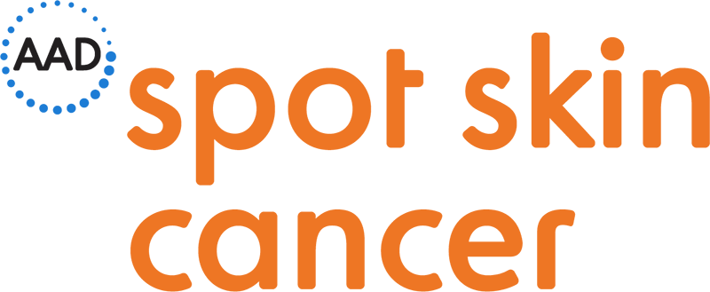 Spot Logo