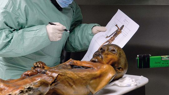 Otzi the Iceman Ate a High-fat Last Meal