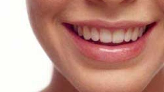 How Tooth Whitening Works