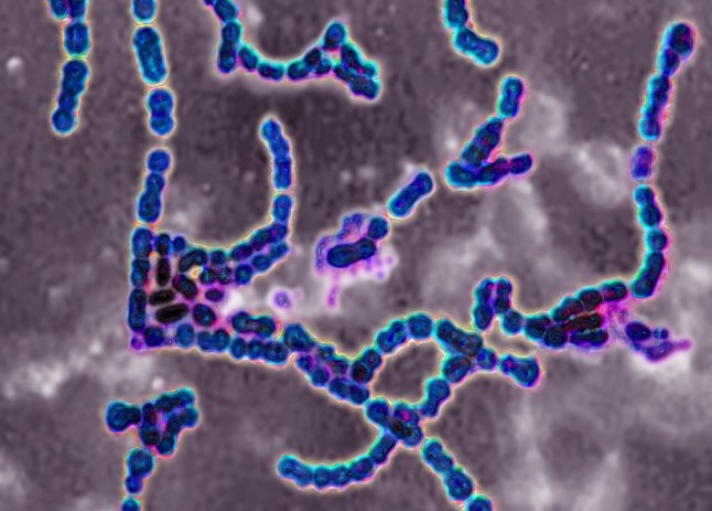 Streptococcus pyogenes A. Bacteria responsible for skin infections, impetigo, abscesses and bronchial-pulmonary infections. Seen under optical microscopy X 1000. (Photo by: BSIP/Universal Images Group via Getty Images)