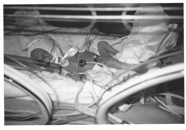 Sharon Darke: I lost both my twins in a premature birth (Baby Loss Awareness Week, 9-15 October)