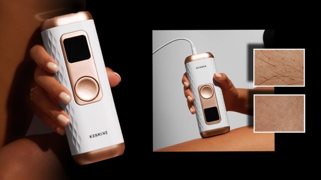 Image of a electrical hair removal device that's being used on a body part, with before and after images included.