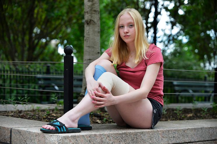 Ava Aldrich still wears bandages on her legs after the May 4th acid attack.