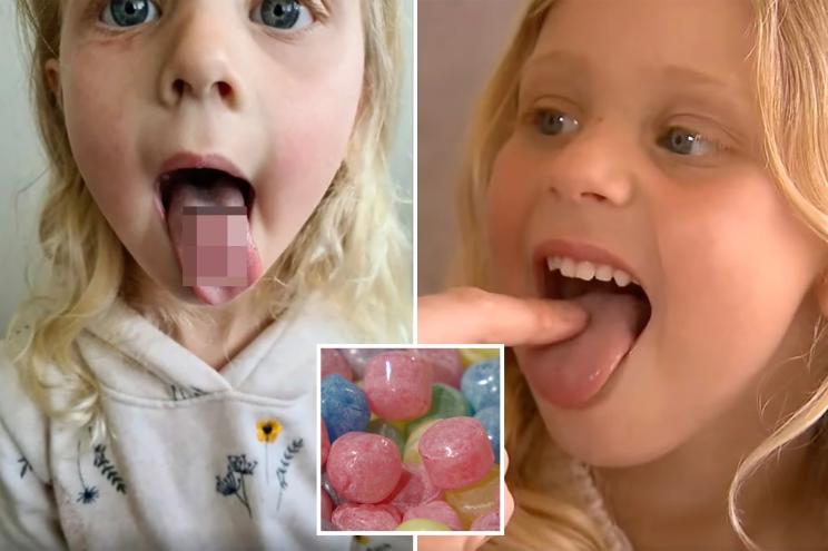 An Australian girl likely won't look at candy the same way again after her snack of sour Warheads candies allegedly left her with a hole in her tongue.