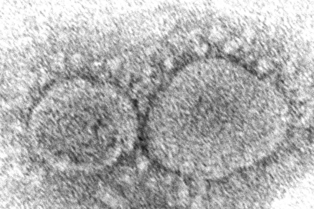 This 2020 electron microscope image made available by the Centers for Disease Control and Prevention shows SARS-CoV-2 virus particles, which cause COVID-19. 