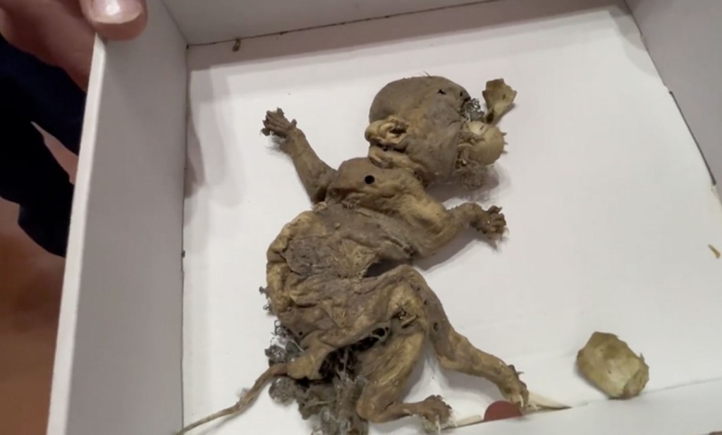 The alleged "goblin fetus."