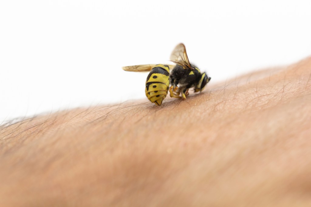 The bee lands on the surface of the skin before deploying its stinger. 