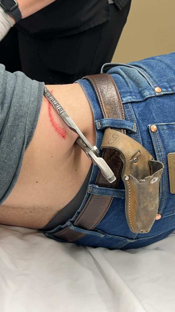  Joey Zeman with pliers inside his body