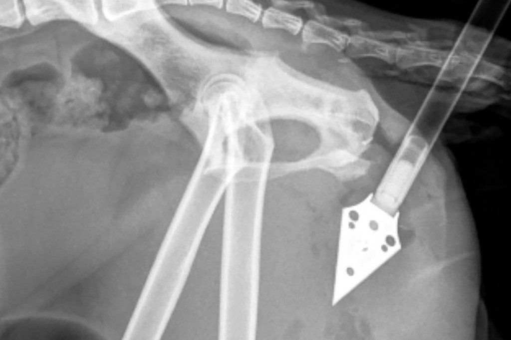 An x-ray image showed how close the arrow point was to her bones.