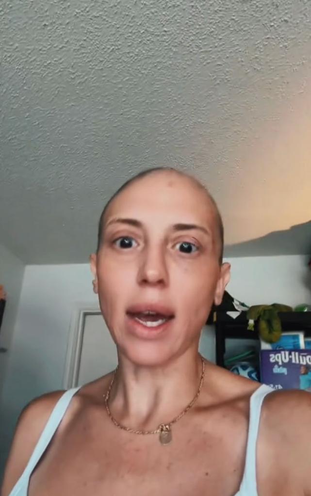 Mom living with alopecia reacts to liberal women shaving heads to be 'unattractive' after Donald Trump's win.