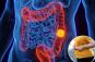 New study uncovers the biggest risk factor for colon cancer in under 35s — and it will shock you