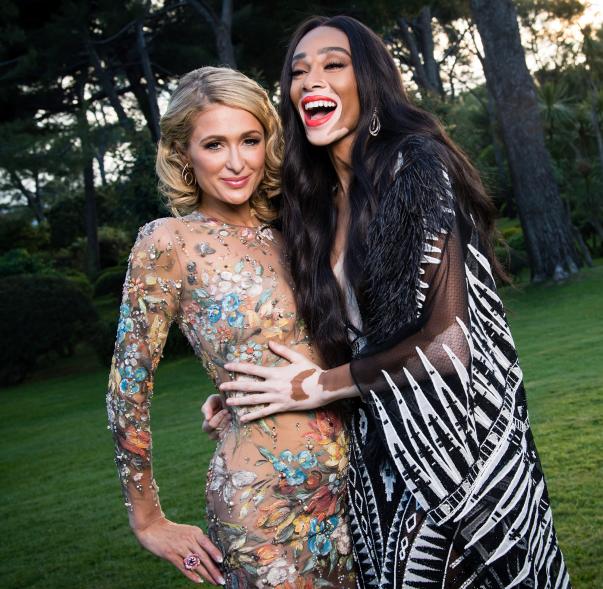 Paris Hilton and Winnie Harlow posing for a photo together.