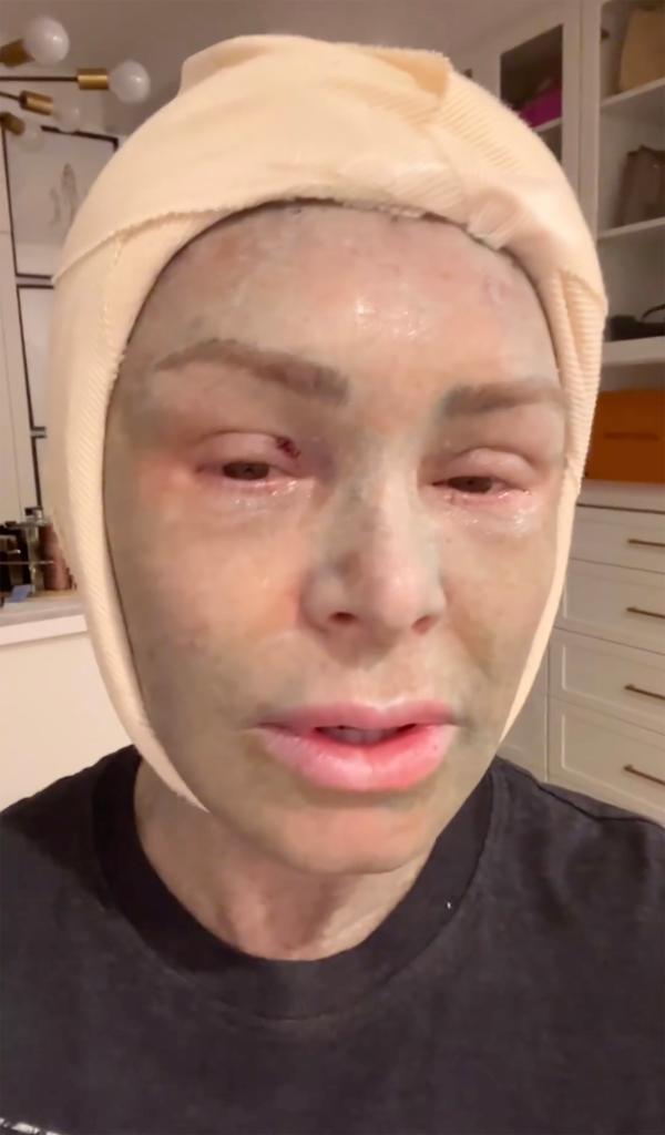 A selfie of Tamra Judge after her plastic surgery