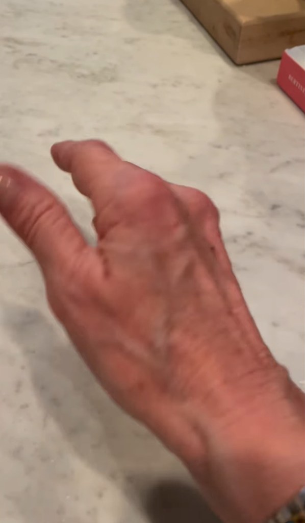 Valerie Bertinelli hand IG