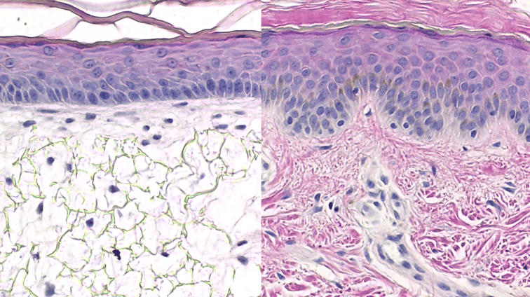 How to bioengineer epithelial tissues in vitro