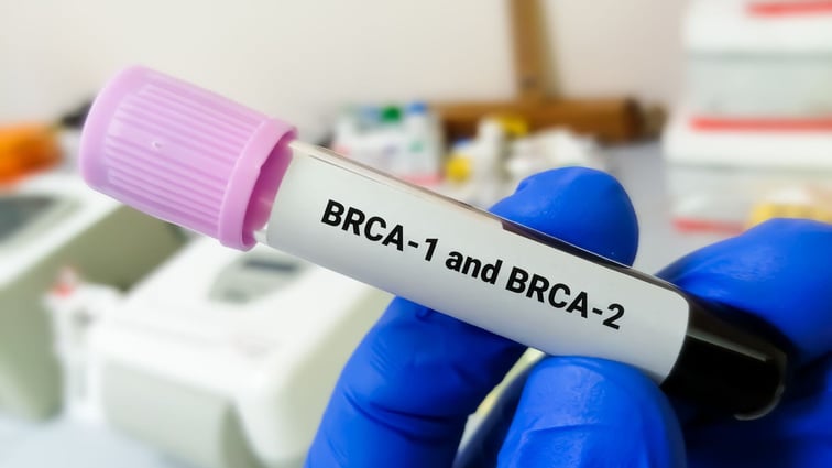 High Prevalence of BRCA Mutations in Indian Breast Cancer Patients: Insights from a Diagnostic Lab