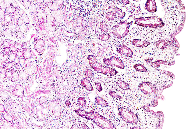 How to Characterize the Barrier Properties of Alvetex®-Based Mucosal Models