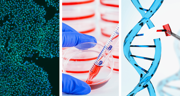 3 challenges facing the introduction of iPSC-derived therapies