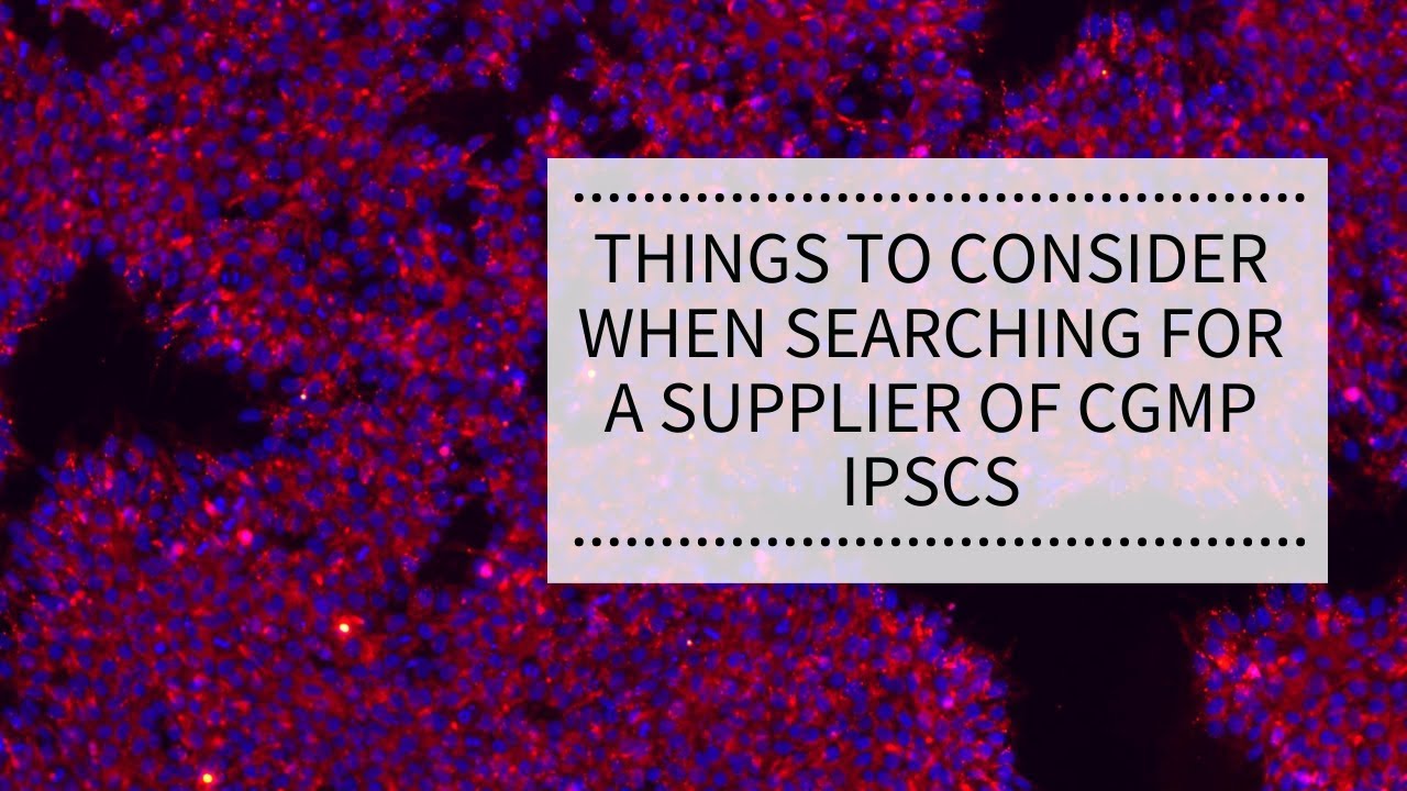 WEBINAR: Things to consider when searching for a supplier of cGMP iPSCs