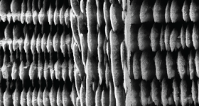 A close up of 3D printed Si-rich glass micro-supercapacitors (MSCs) on silicon substrates - magnified by 4720 times. Image via KTH Royal Institute of Technology.