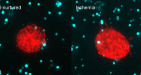 Time lapse of Cancer Cell Behavior Under Different Conditions. Photo via NYU.