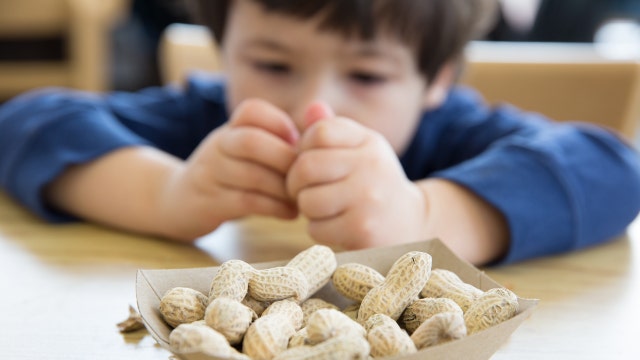 Peanut allergy surprise, best diets, traffic exposure risk - Fox News