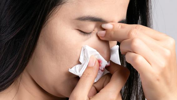 Person with a nose bleed, with head bent down, eyes closed and holding bloody tissue to notrils