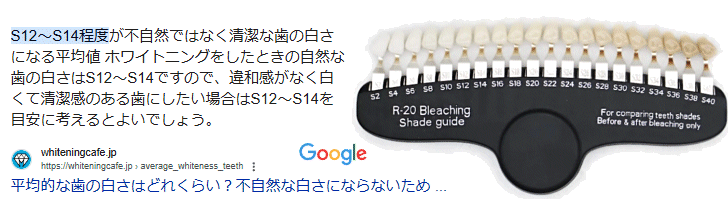 平均的な歯の白さはどれくらい