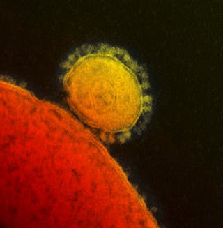 Handout transmission electron micrograph shows the Middle East respiratory syndrome (MERS) coronavirus