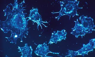 Cancer_cells_(1)