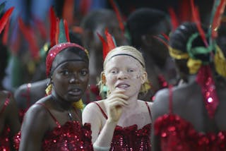 An albino Nigerian girl observes the festivities at the national stadium during the end of All Africa Games in Abuja