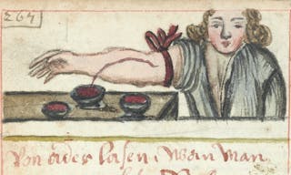 WMS_990_Bloodletting_Wellcome_L00410742