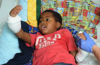 Boy Becomes First Pediatric Double-Hand Transplant Recipient