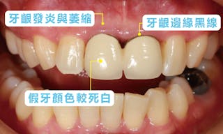 關鍵評論首圖重製0303ver