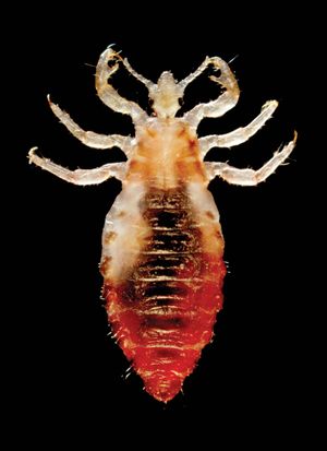 body louse