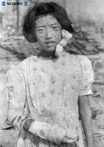 【広島】顔や手に負傷した少女＝１９４５（昭和２０）年８月９日