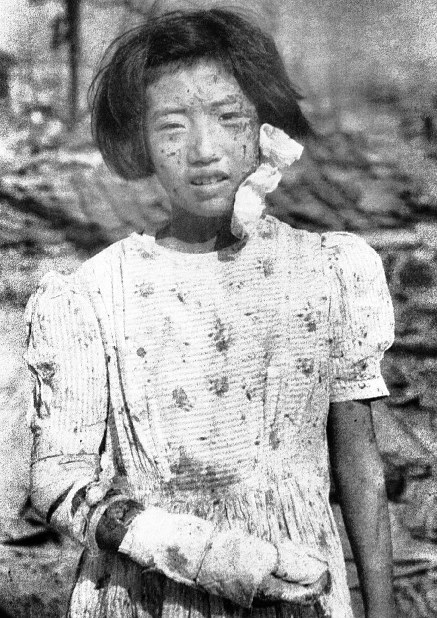 被爆３日後の広島市内で、国平幸男元記者が撮影した少女＝広島市で１９４５年８月９日