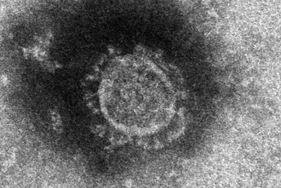 国立感染症研究所が分離した新型コロナウイルスの電子顕微鏡写真＝同研究所提供