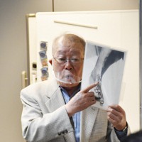 被爆して変形した自分の足の写真を見せながら、修学旅行生に体験を語る小峰さん＝長崎市で2022年4月26日午後2時53分、中山敦貴撮影