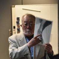 被爆して変形した自分の足の写真を見せながら、修学旅行生に体験を語る小峰さん