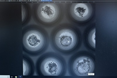 京都大iPS細胞研究所の高島康弘教授が開発した胚モデルの顕微鏡画像＝京都市左京区で2024年2月2日、川平愛撮影
